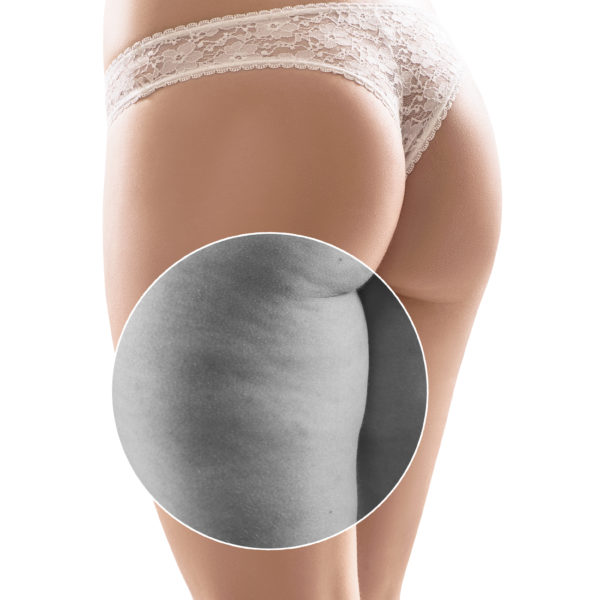 Cellulize - Off